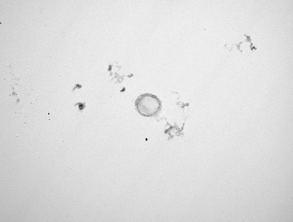 Exosomes for drug delivery